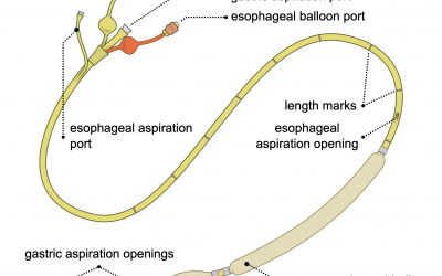Blakemore Tube Insertion